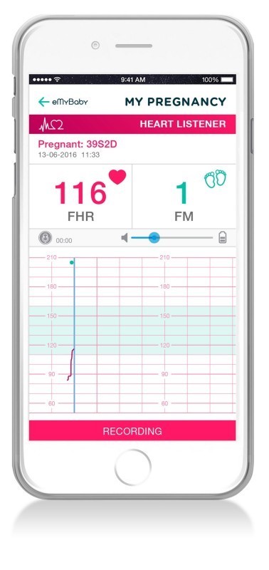Детектор сердечного ритма плода Miniland SweetBeat, ML89304